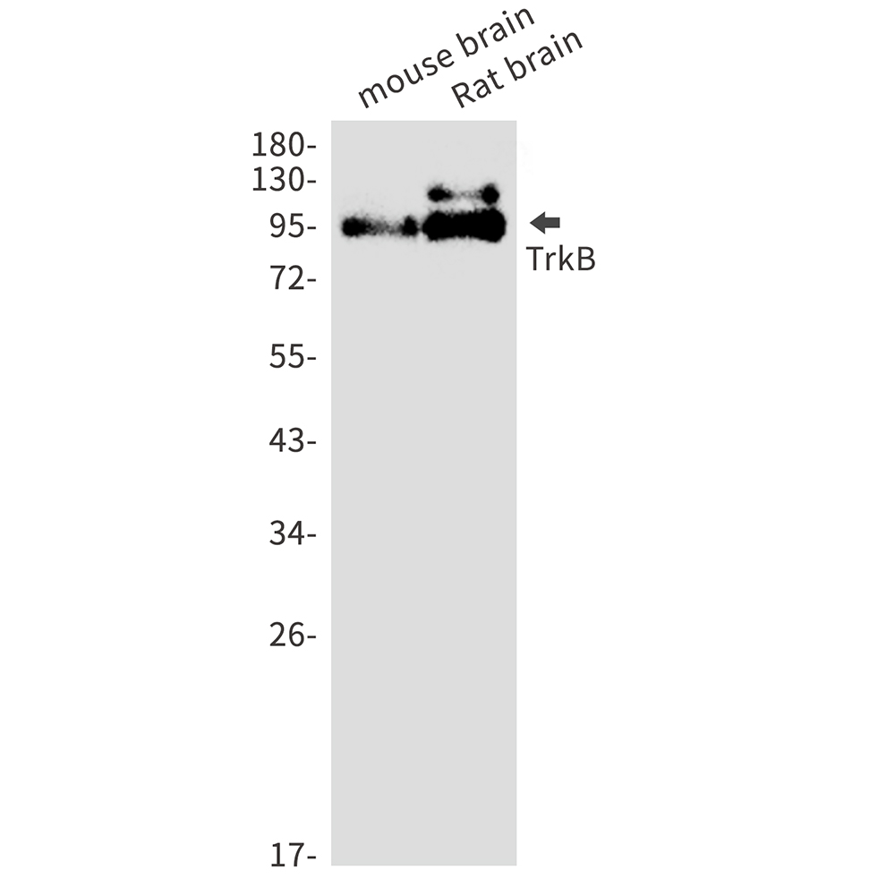 Rabbit monoclonal antibody