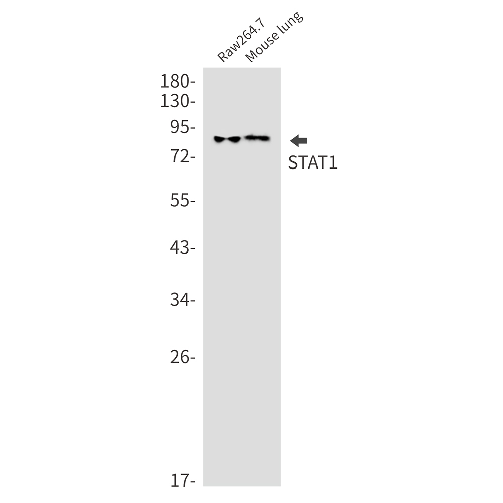 Rabbit monoclonal antibody