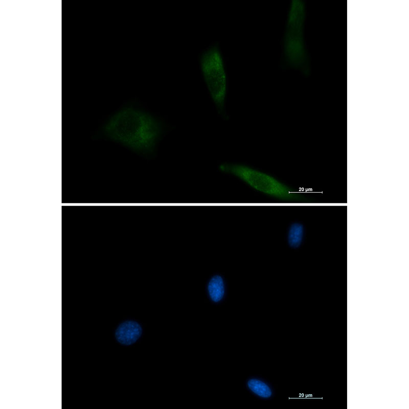 Rabbit monoclonal antibody