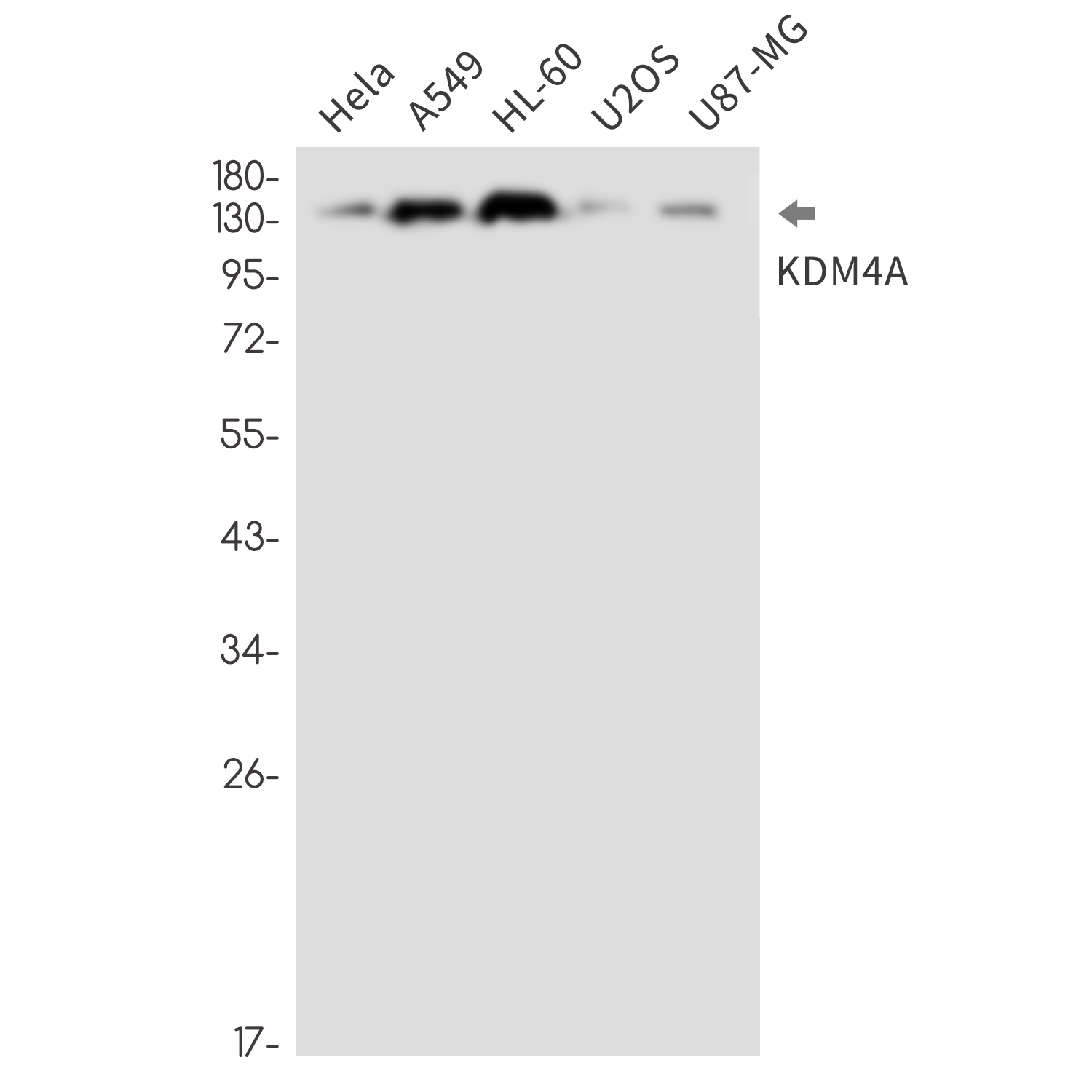 Rabbit monoclonal antibody
