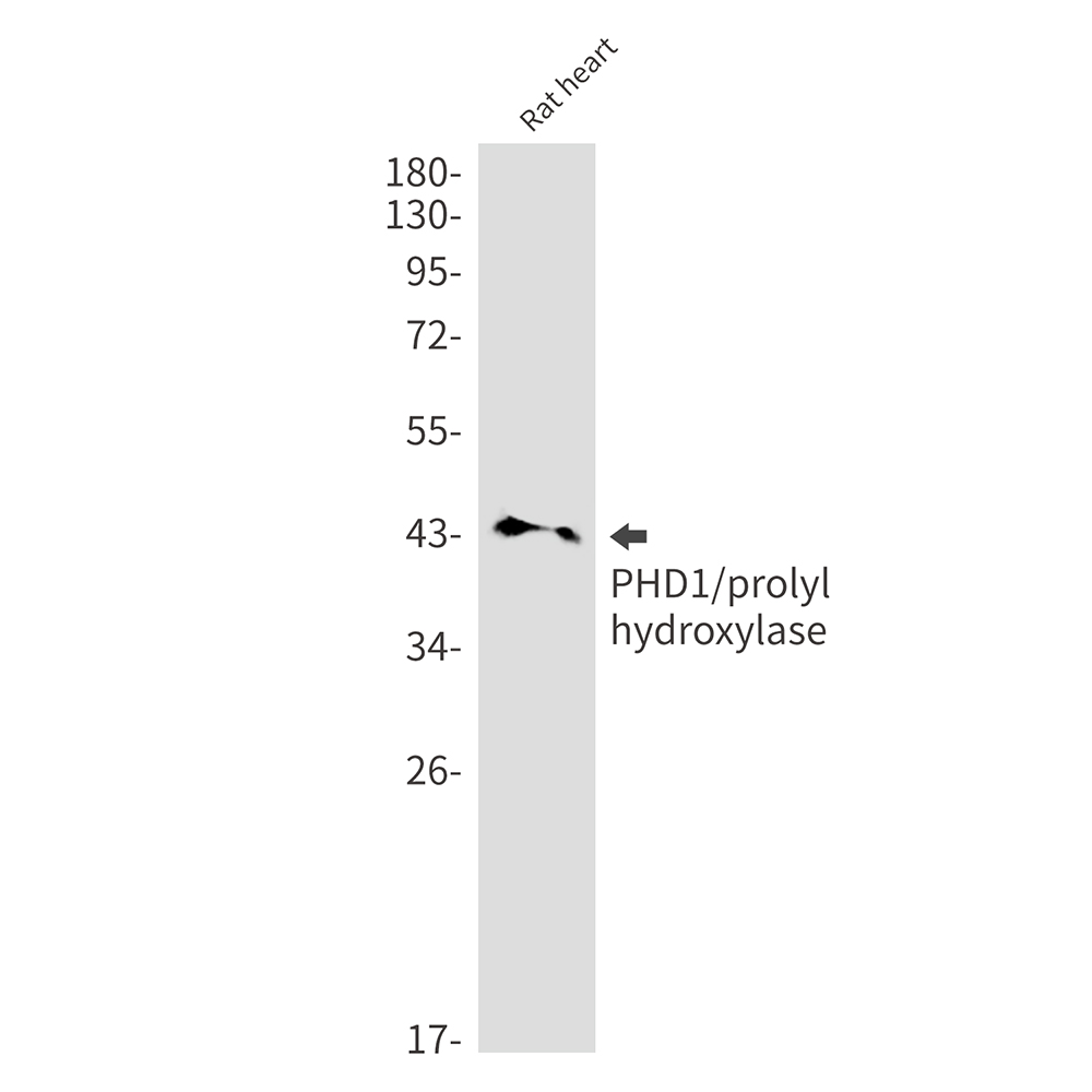 Rabbit monoclonal antibody