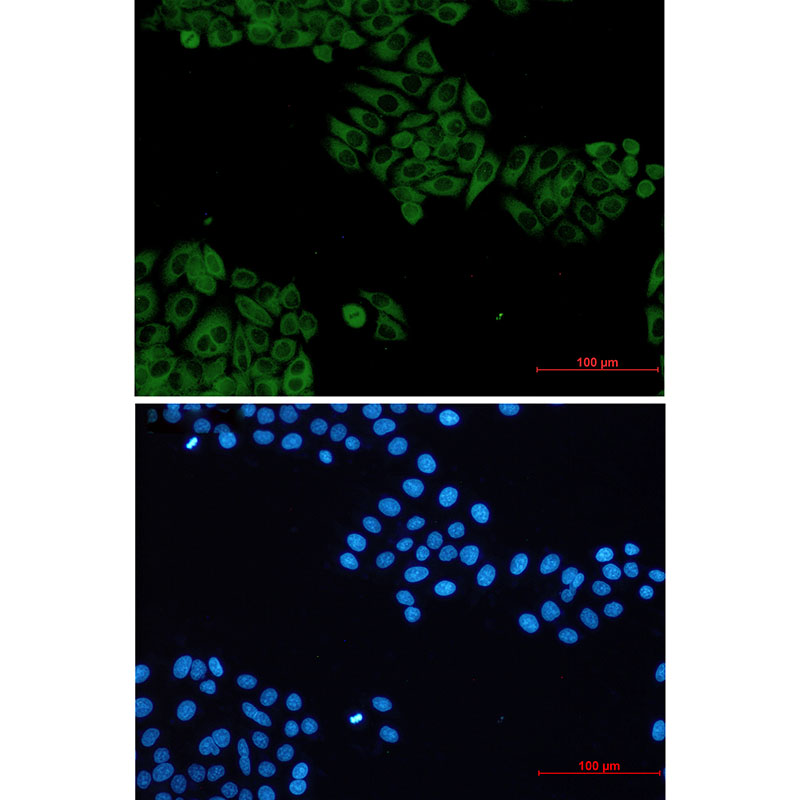 Rabbit monoclonal antibody
