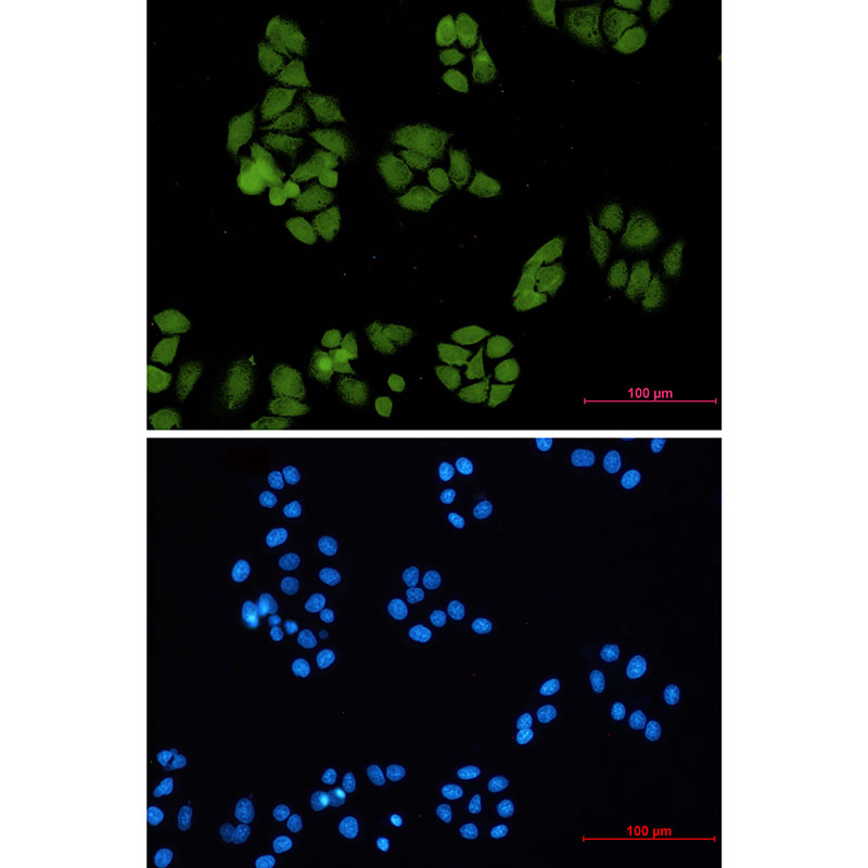 Rabbit monoclonal antibody
