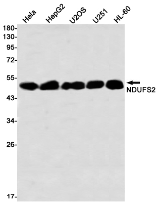 Rabbit monoclonal antibody