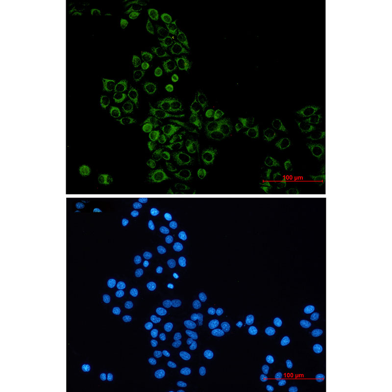 Rabbit monoclonal antibody