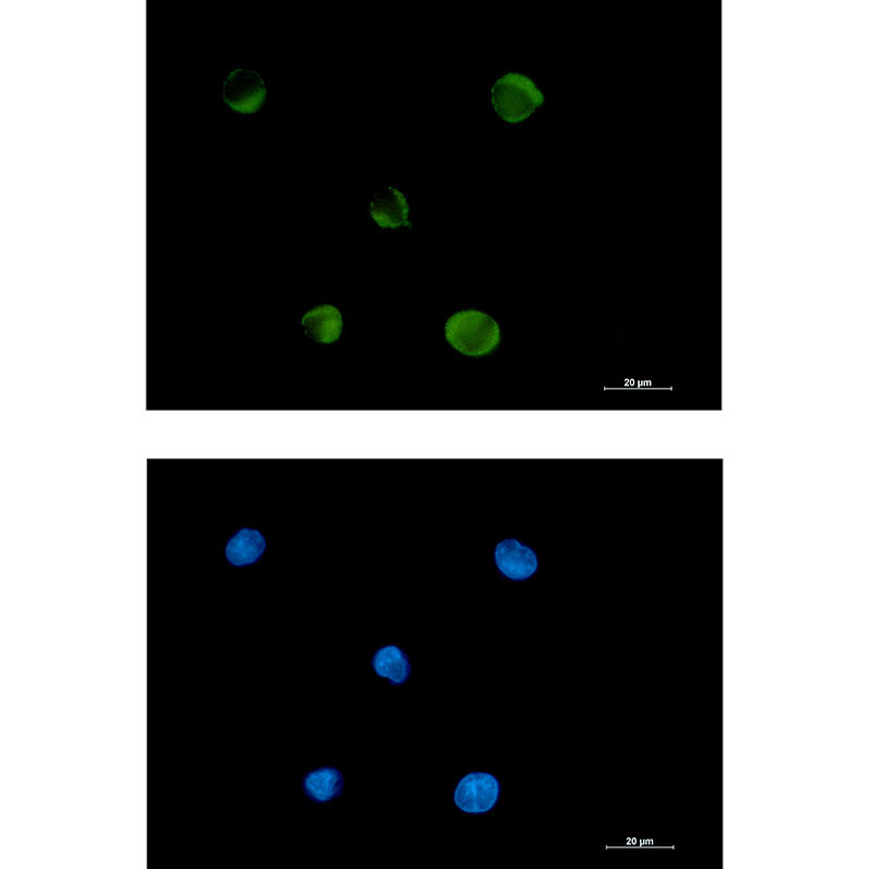 Rabbit monoclonal antibody