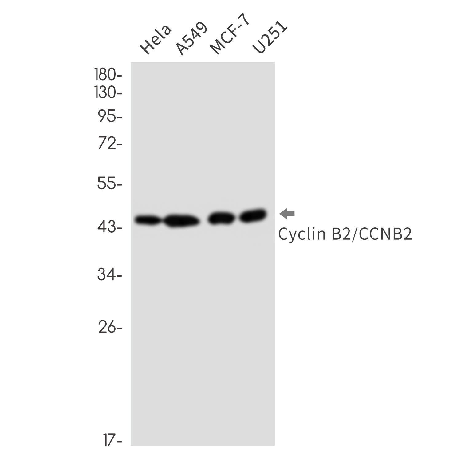 Rabbit monoclonal antibody