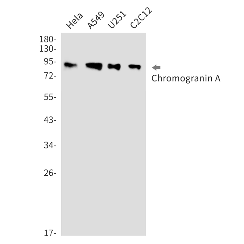 Rabbit monoclonal antibody