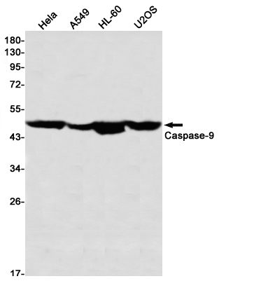 Rabbit monoclonal antibody