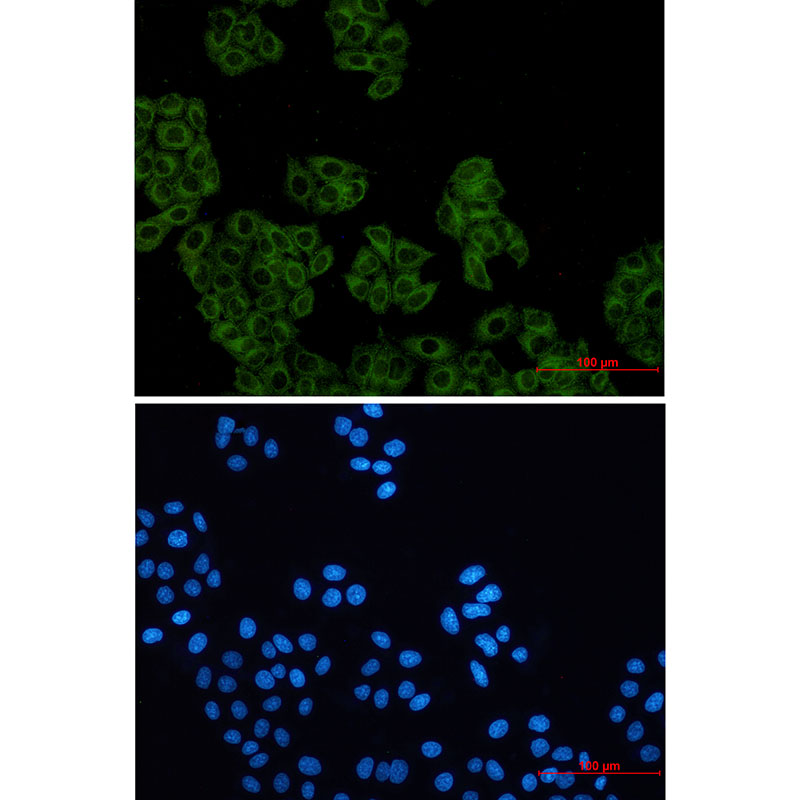 Rabbit monoclonal antibody