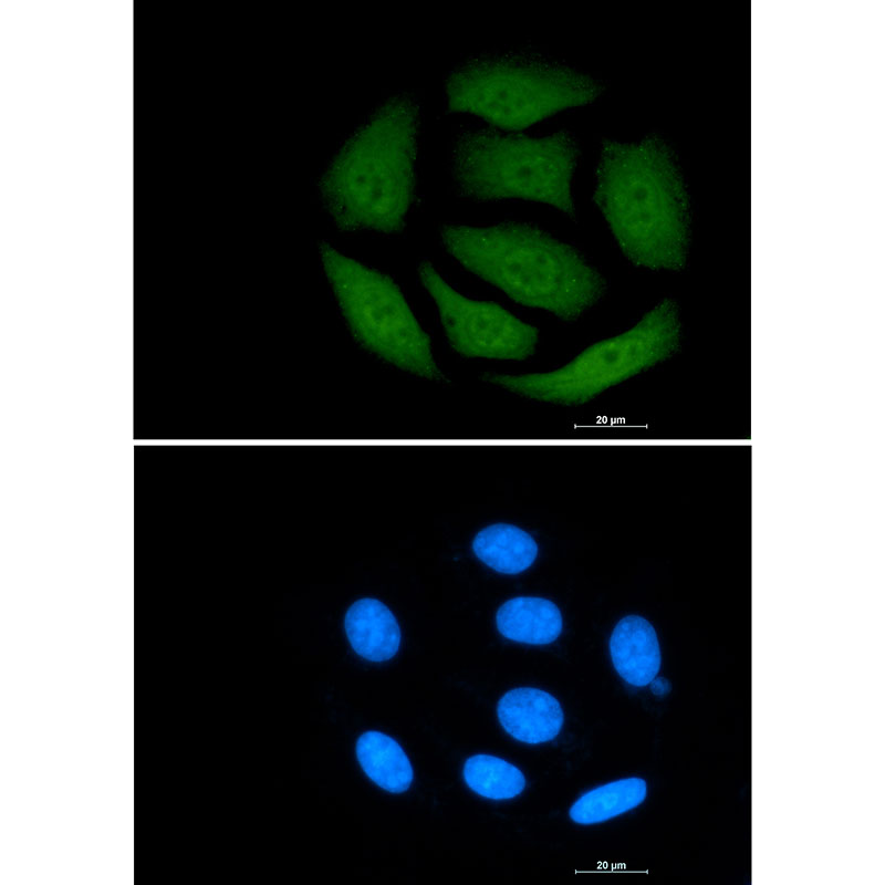 Rabbit monoclonal antibody