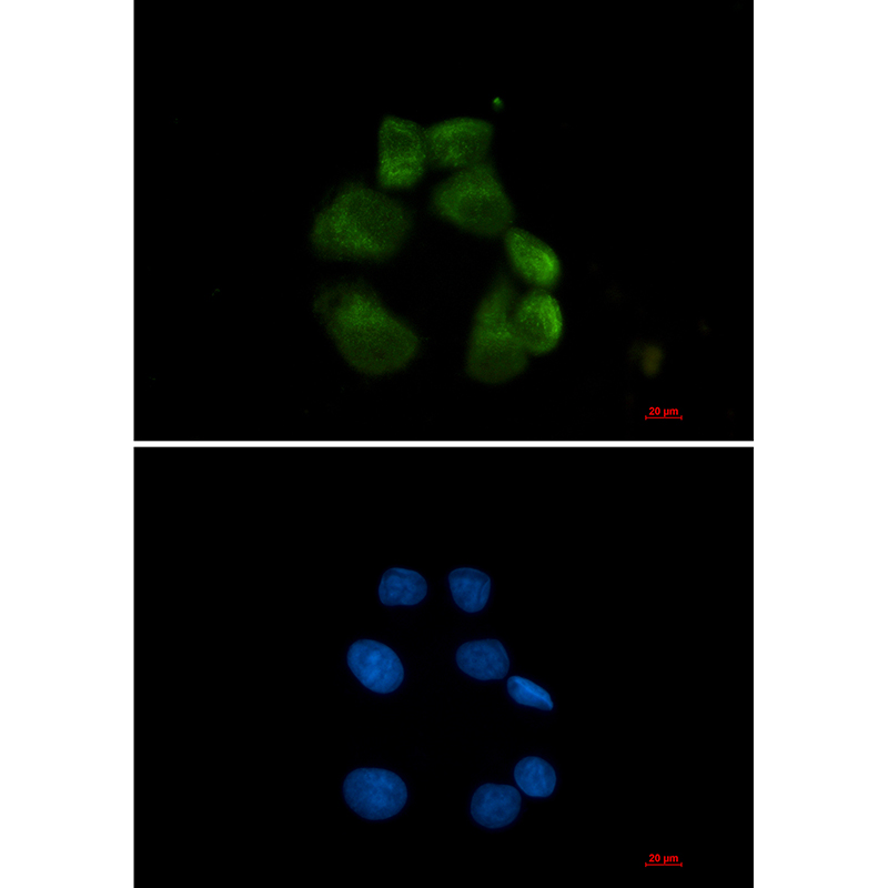 Rabbit monoclonal antibody