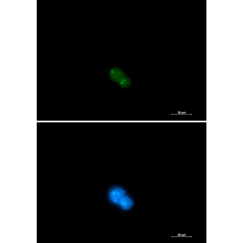 Rabbit monoclonal antibody