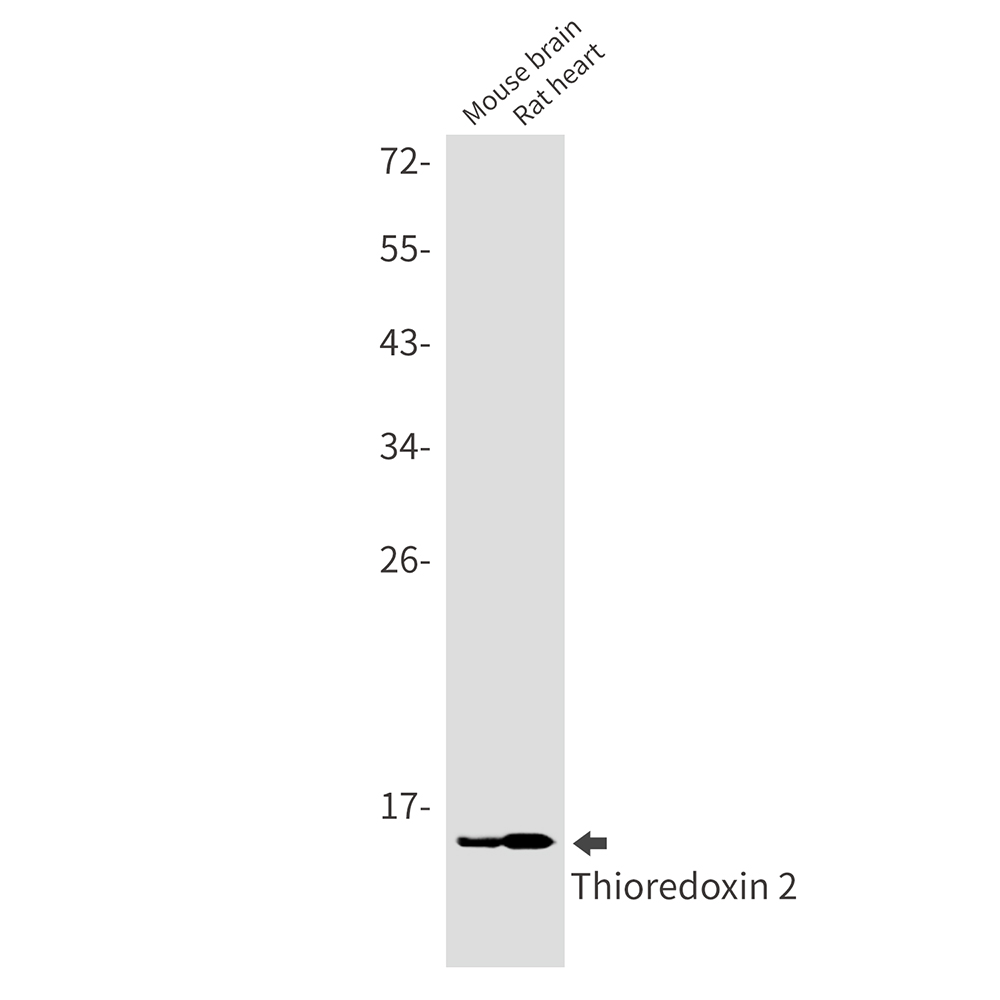 Rabbit monoclonal antibody
