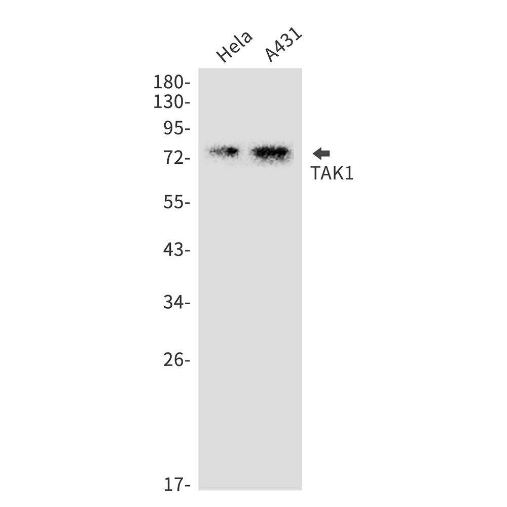 Rabbit monoclonal antibody