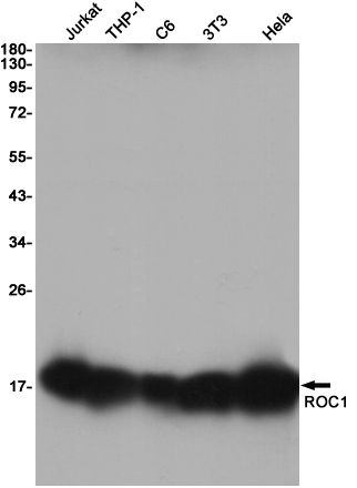 Rabbit monoclonal antibody