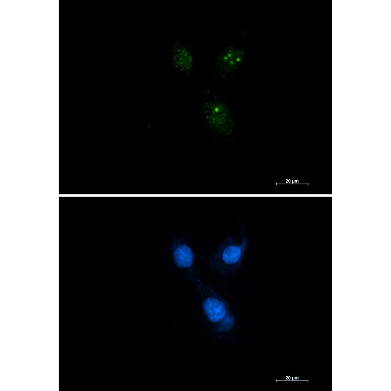 Rabbit monoclonal antibody