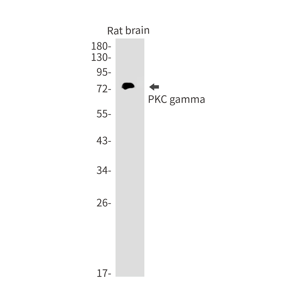 Rabbit monoclonal antibody