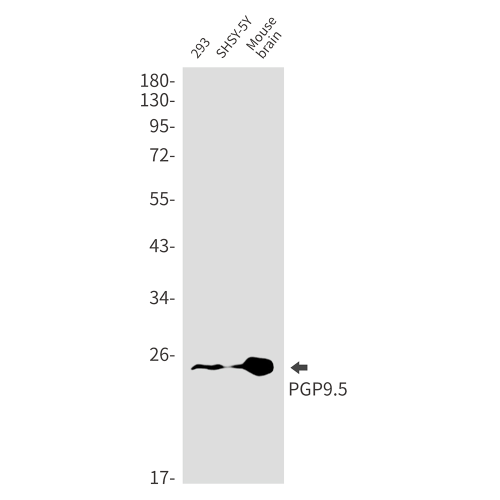 Rabbit monoclonal antibody