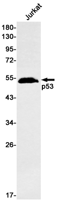 Rabbit monoclonal antibody