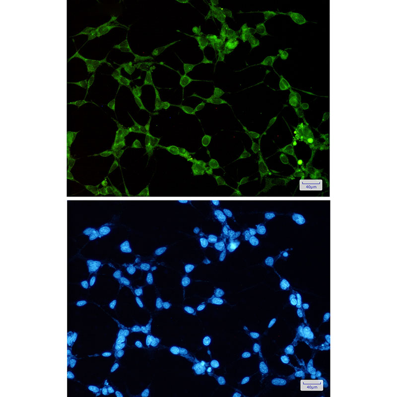 Rabbit monoclonal antibody