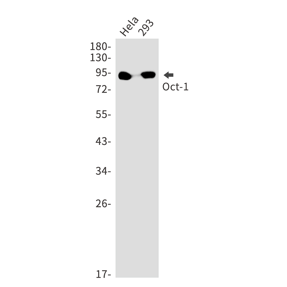 Rabbit monoclonal antibody