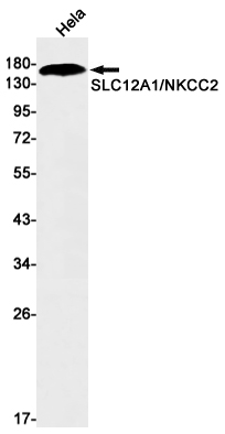 Rabbit monoclonal antibody