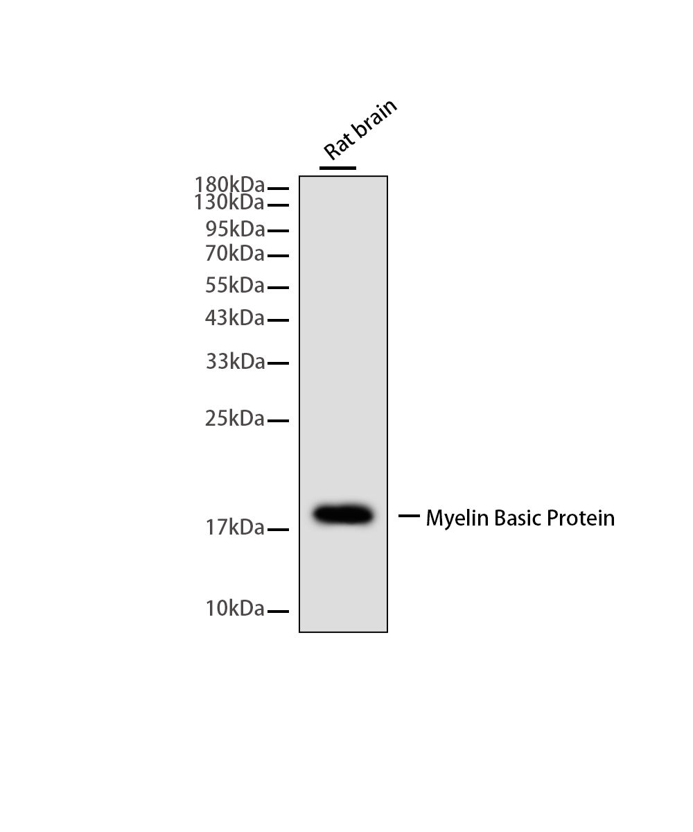 Rabbit monoclonal antibody