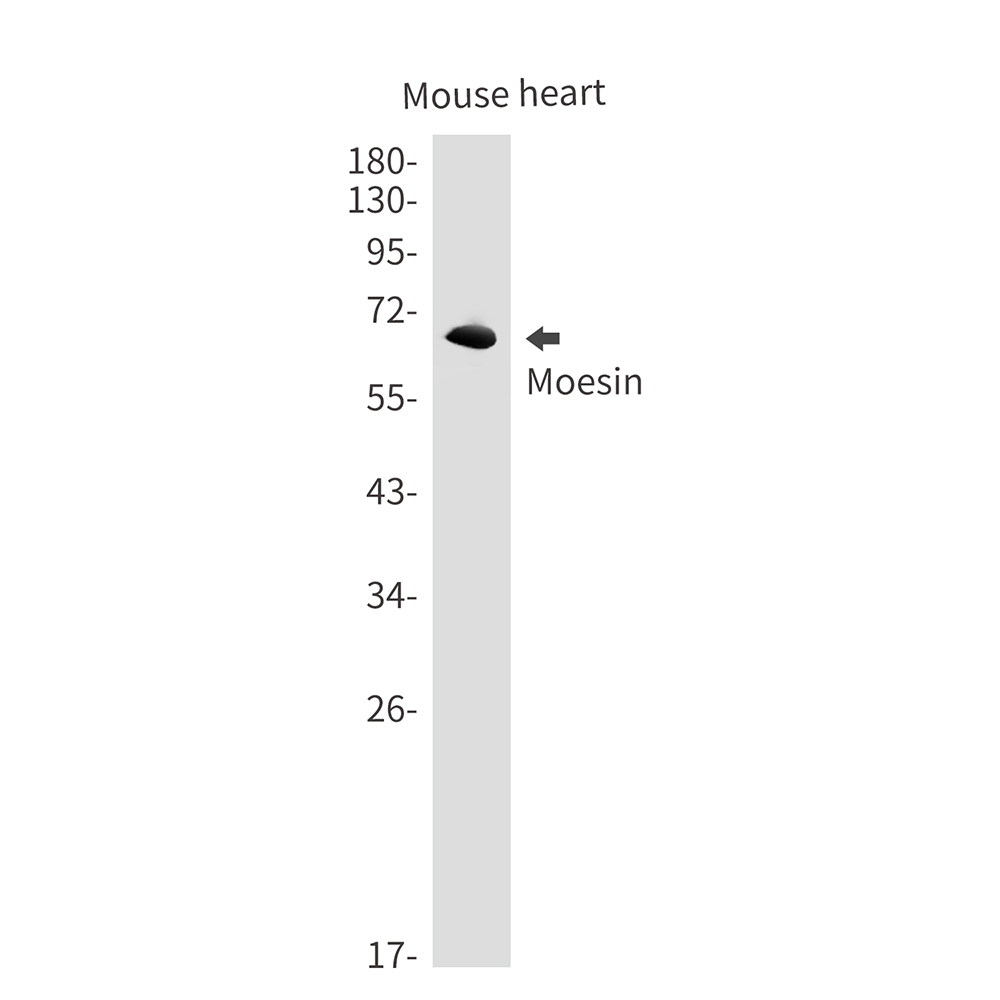 Rabbit monoclonal antibody