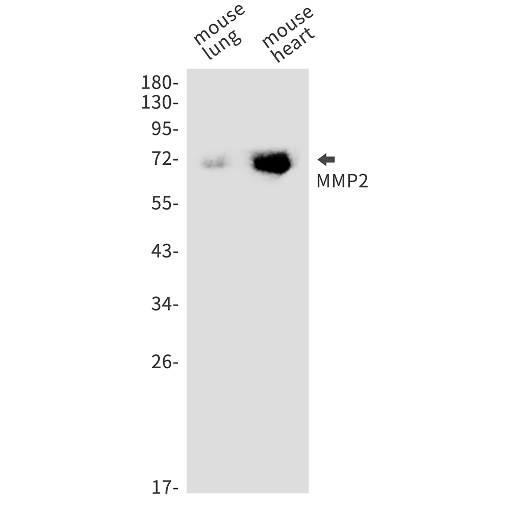 Rabbit monoclonal antibody