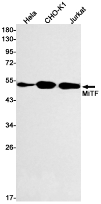 Rabbit monoclonal antibody
