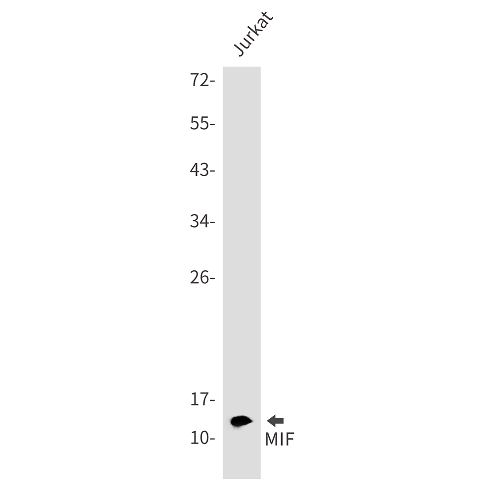 Rabbit monoclonal antibody