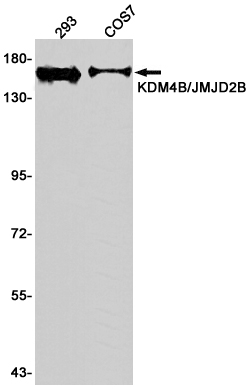 Rabbit monoclonal antibody