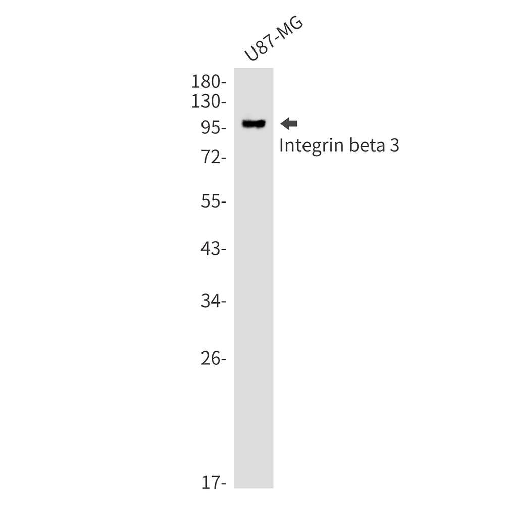 Rabbit monoclonal antibody