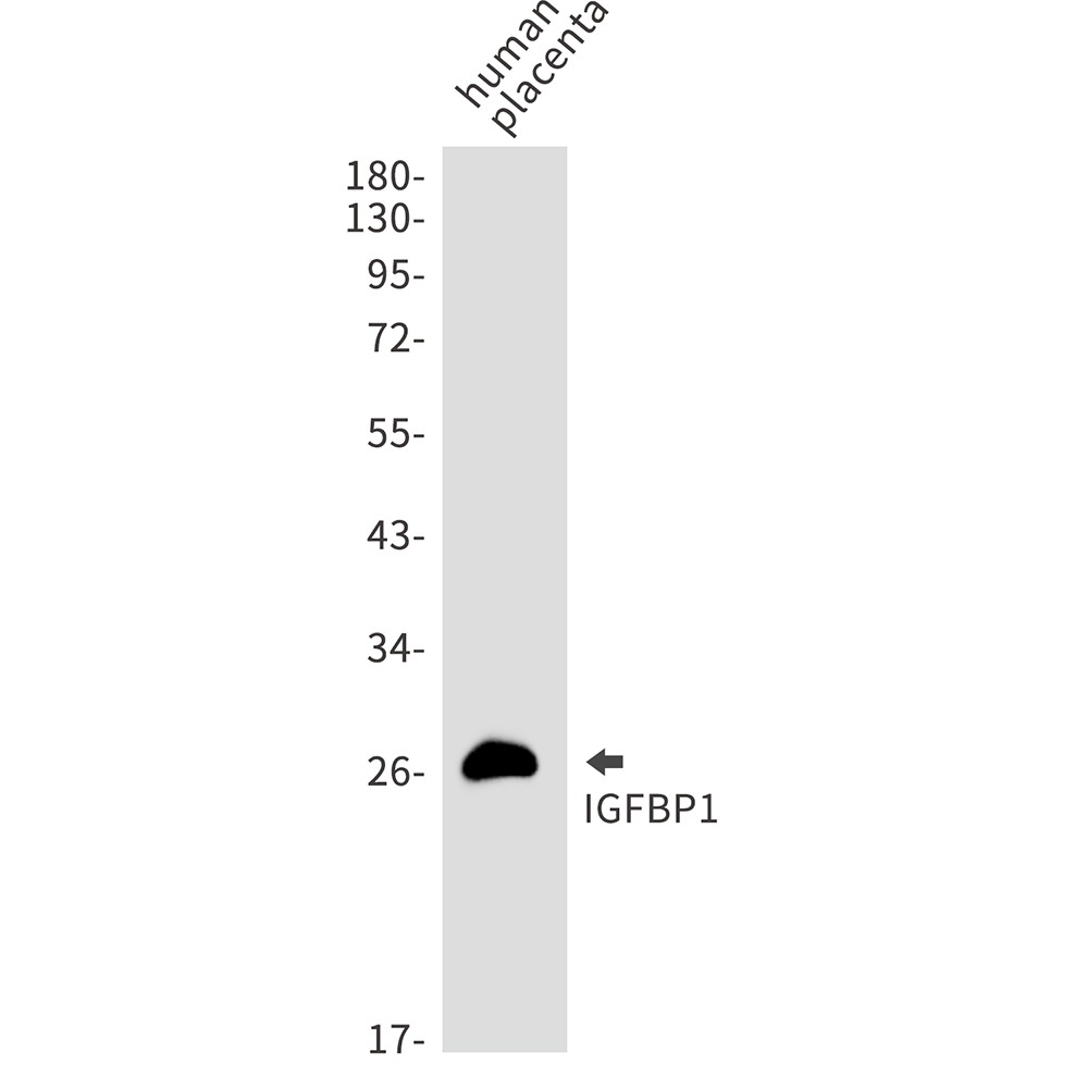 Rabbit monoclonal antibody