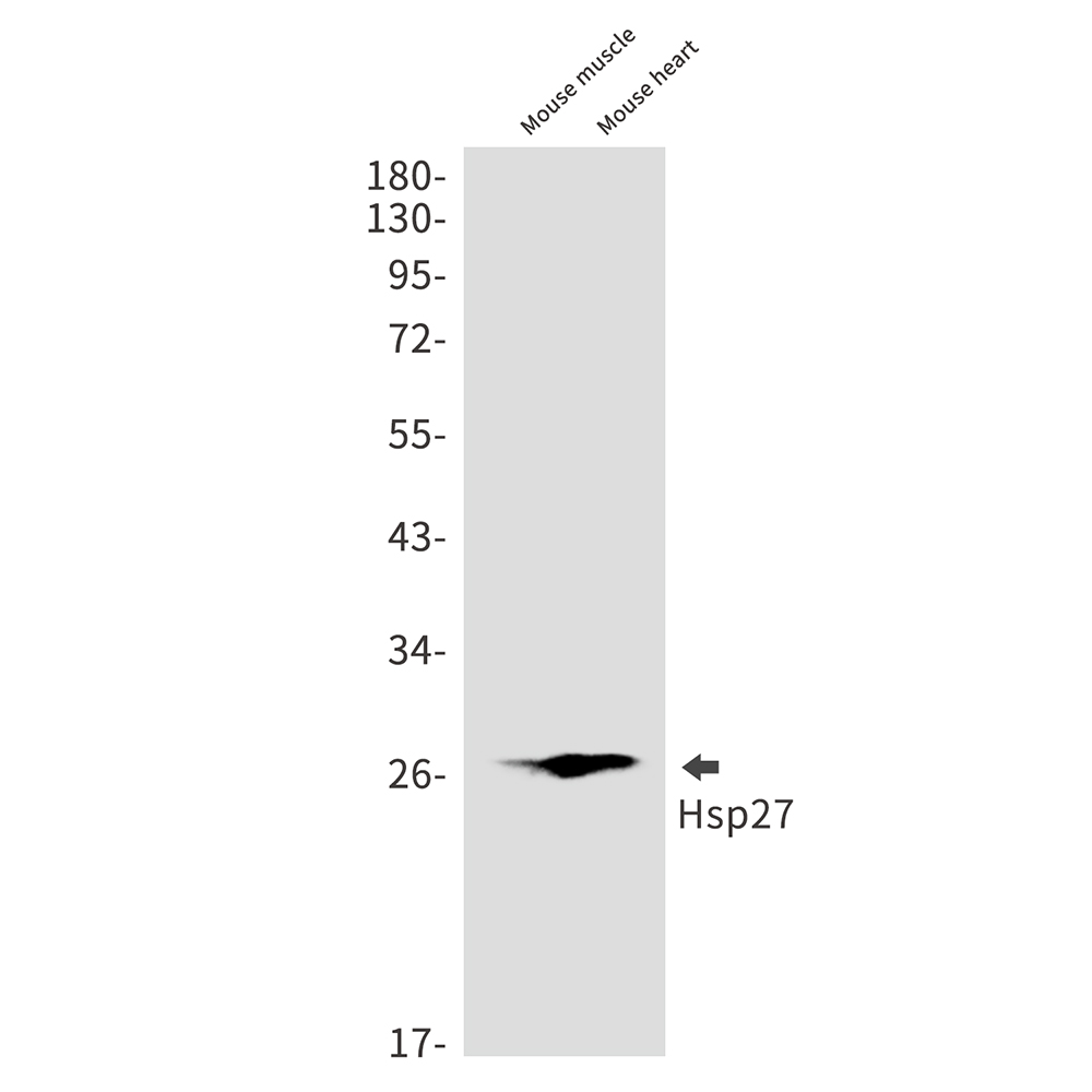 Rabbit monoclonal antibody