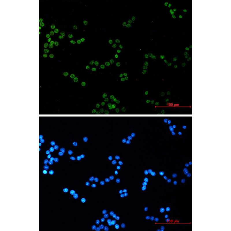Rabbit monoclonal antibody