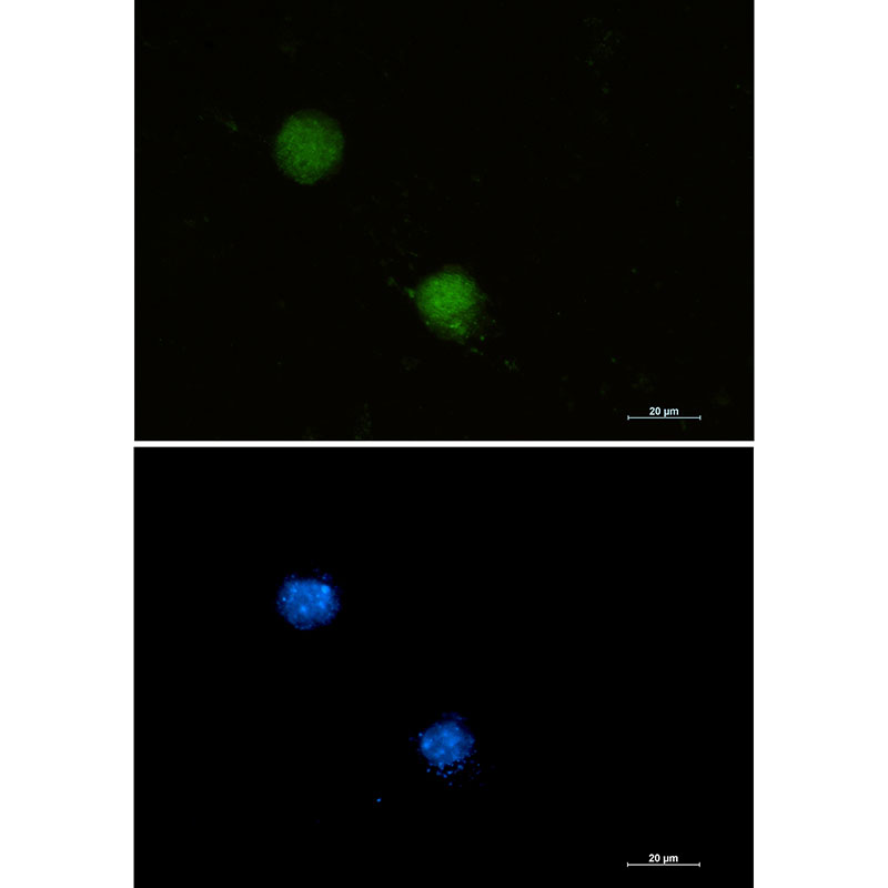 Rabbit monoclonal antibody