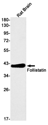 Rabbit monoclonal antibody