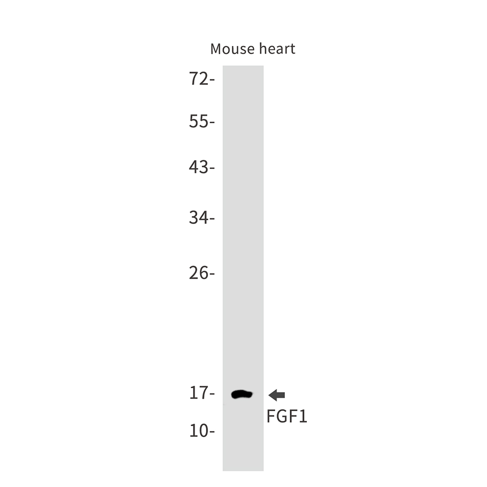 Rabbit monoclonal antibody