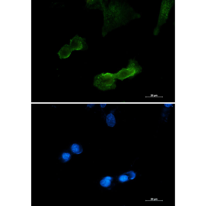 Rabbit monoclonal antibody