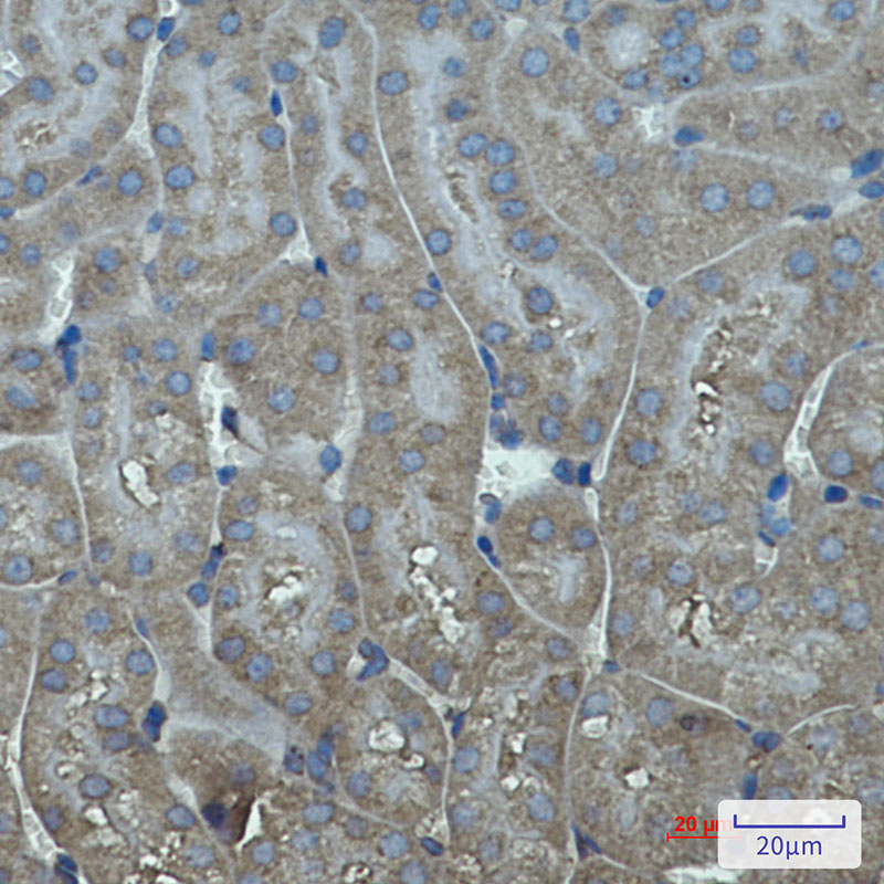 Rabbit monoclonal antibody