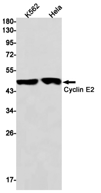 Rabbit monoclonal antibody