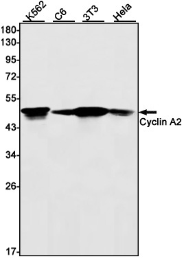 Rabbit monoclonal antibody
