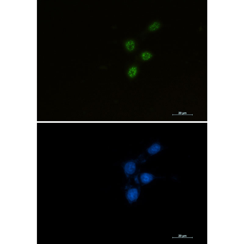 Rabbit monoclonal antibody