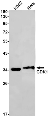 Rabbit monoclonal antibody