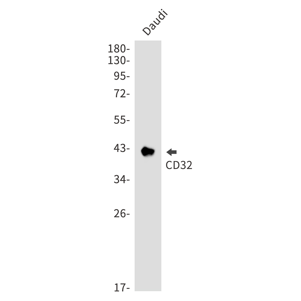 Rabbit monoclonal antibody