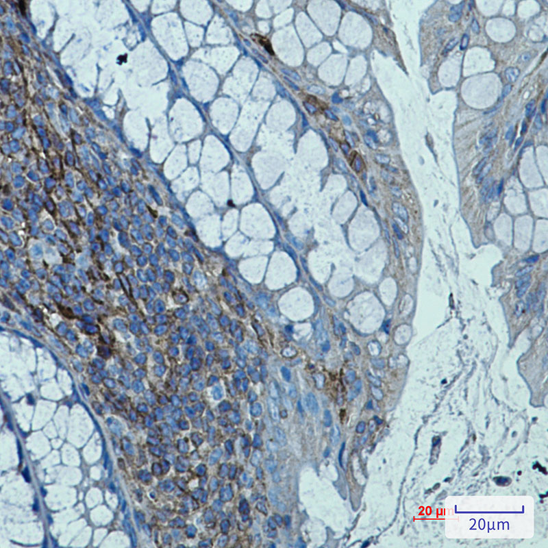 Rabbit monoclonal antibody