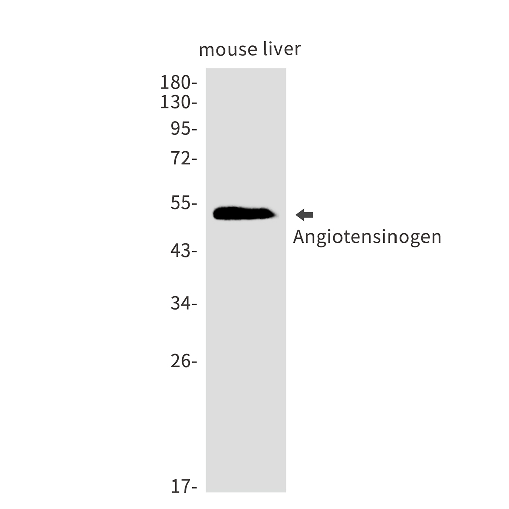 Rabbit monoclonal antibody