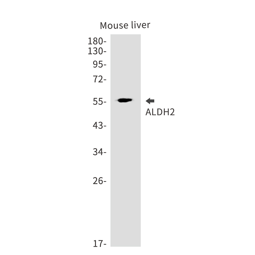 Rabbit monoclonal antibody